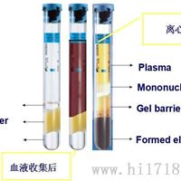 PRP管 BD 362761真空采血管 采血管